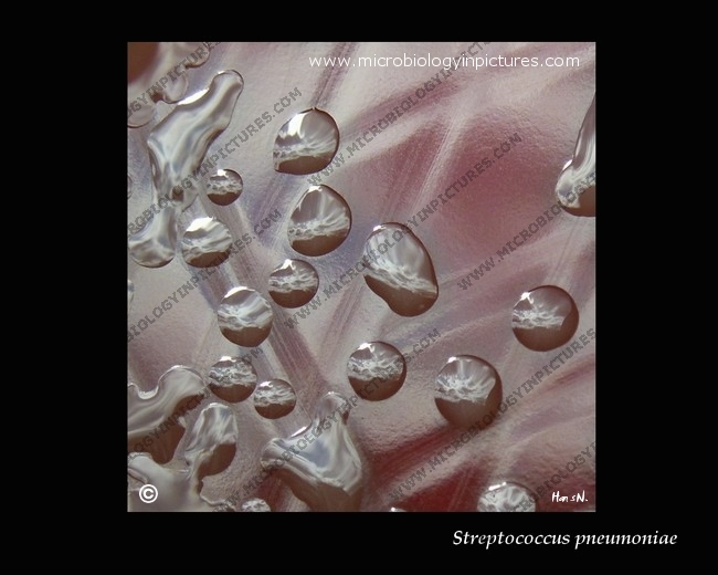 encapsulated S.pneumoniae colony morphology in M-phase